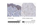 Immunohistochemistry analysis in human skin and skeletal muscle tissues using HPA040802 antibody. Corresponding VPS35 RNA-seq data are presented for the same tissues.