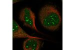 Immunofluorescent staining of human cell line U-2 OS shows localization to nucleoli fibrillar center & cytosol.