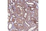 Immunohistochemical staining of human kidney shows strong cytoplasmic positivity in distal tubules.