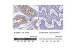 Immunohistochemistry analysis in human testis and endometrium tissues using Anti-AC004381.6 antibody. Corresponding AC004381.6 RNA-seq data are presented for the same tissues.