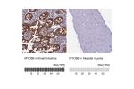 Immunohistochemistry analysis in human small intestine and skeletal muscle tissues using HPA040902 antibody. Corresponding MYO5B RNA-seq data are presented for the same tissues.