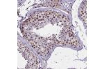 Immunohistochemical staining of human testis shows moderate nuclear positivity in cells in seminiferous ducts.