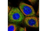 Immunofluorescent staining of human cell line A-431 shows localization to plasma membrane & cytosol.