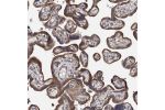 Immunohistochemical staining of human placenta shows strong cytoplasmic positivity in trophoblastic cells.