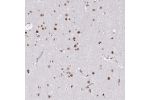 Immunohistochemical staining of human cerebral cortex shows strong nuclear positivity in neurons.