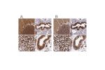 Immunohistochemical staining of human cerebellum, fallopian tube, kidney and testis using Anti-TRAP1 antibody HPA041082 (A) shows similar protein distribution across tissues to independent antibody HPA044227 (B).