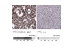 Immunohistochemistry analysis in human parathyroid gland and liver tissues using HPA041086 antibody. Corresponding FTO RNA-seq data are presented for the same tissues.