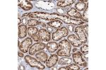 Immunohistochemical staining of human kidney shows strong cytoplasmic and nuclear positivity in renal tubules.