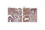 Immunohistochemical staining of human adrenal gland, colon, gallbladder and kidney using Anti-STUB1 antibody HPA041222 (A) shows similar protein distribution across tissues to independent antibody HPA043531 (B).