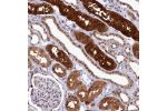 Immunohistochemical staining of human kidney shows strong cytoplasmic and nuclear positivity in cells in tubules.
