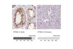 Immunohistochemistry analysis in human testis and pancreas tissues using HPA041270 antibody. Corresponding KPNA2 RNA-seq data are presented for the same tissues.