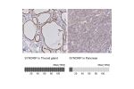 Immunohistochemistry analysis in human thyroid gland and pancreas tissues using Anti-SYNCRIP antibody. Corresponding SYNCRIP RNA-seq data are presented for the same tissues.