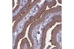 Immunohistochemical staining of human Fallopian tube shows strong staining in cilia, as well as cytoplasmic positivity in glandular cells.