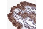 Immunohistochemical staining of human fallopian tube shows strong nuclear positivity in glandular cells.