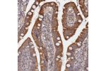 Immunohistochemical staining of human duodenum shows strong positivity in glandular cells.