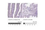 Immunohistochemistry analysis in human fallopian tube and prostate tissues using Anti-C10orf107 antibody. Corresponding C10orf107 RNA-seq data are presented for the same tissues.