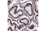 Immunohistochemical staining of human endometrium shows strong nuclear positivity in glandular cells.