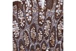 Immunohistochemical staining of human colon shows strong cytoplasmic positivity in glandular cells.