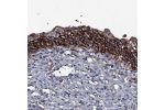Immunohistochemical staining of human urinary bladder shows strong cytoplasmic and membranous positivity in urothelial cells.