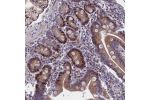 Immunohistochemical staining of human duodenum shows distinct nuclear positivity in glandular cells.