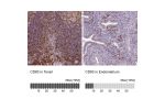 Immunohistochemistry analysis in human tonsil and endometrium tissues using HPA041454 antibody. Corresponding CD83 RNA-seq data are presented for the same tissues.