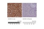 Immunohistochemistry analysis in human liver and pancreas tissues using HPA041487 antibody. Corresponding SULT2A1 RNA-seq data are presented for the same tissues.