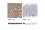Immunohistochemistry analysis in human kidney and pancreas tissues using Anti-PRDX3 antibody. Corresponding PRDX3 RNA-seq data are presented for the same tissues.