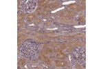 Immunohistochemistry analysis in human adrenal gland and pancreas tissues using Anti-FAM96B antibody. Corresponding FAM96B RNA-seq data are presented for the same tissues.