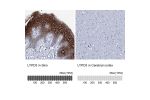 Immunohistochemistry analysis in human skin and cerebral cortex tissues using HPA041529 antibody. Corresponding LYPD3 RNA-seq data are presented for the same tissues.