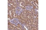 Immunohistochemical staining of human kidney shows strong granular cytoplasmic positivity in cells in tubules.