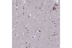 Immunohistochemical staining of human cerebral cortex shows distinct positivity in endothelial cells.