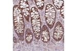 Immunohistochemical staining of human rectum shows moderate granular cytoplasmic positivity in glandular cells.