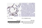 Immunohistochemistry analysis in human lung and skeletal muscle tissues using HPA041602 antibody. Corresponding FTL RNA-seq data are presented for the same tissues.