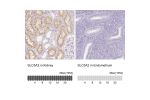 Immunohistochemistry analysis in human kidney and endometrium tissues using HPA041603 antibody. Corresponding SLC5A2 RNA-seq data are presented for the same tissues.