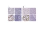 Immunohistochemical staining of human liver, pancreas, pituitary gland and tonsil using Anti-POU1F1 antibody HPA041646 (A) shows similar protein distribution across tissues to independent antibody HPA050624 (B).