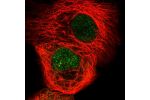 Immunofluorescent staining of human cell line A-431 shows localization to nucleoplasm.