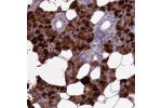 Immunohistochemical staining of human salivary gland shows strong cytoplasmic positivity in glandular cells.