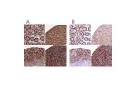 Immunohistochemical staining of human colon, liver, small intestine and spleen using Anti-BLVRB antibody HPA041698 (A) shows similar protein distribution across tissues to independent antibody HPA041937 (B).
