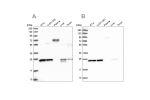 Western blot analysis using Anti-MESDC2 antibody HPA041721 (A) shows similar pattern to independent antibody HPA039414 (B).