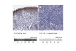 Immunohistochemistry analysis in human skin and lymph node tissues using HPA041724 antibody. Corresponding SULT2B1 RNA-seq data are presented for the same tissues.