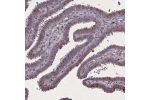 Immunohistochemical staining of human fallopian tube shows moderate cytoplasmic positivity in glandular cells.