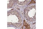 Immunohistochemical staining of human testis shows strong cytoplasmic positivity in Leydig cells.