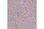 Immunohistochemical staining of human heart muscle shows moderate cytoplasmic positivity in cardiomyocytes.