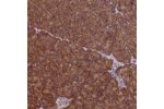 Immunohistochemical staining of human pancreas shows strong cytoplasmic positivity in exocrine glandular cells.
