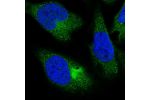 Immunofluorescent staining of human cell line U-2 OS shows positivity in cytoplasm.
