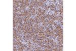 Immunohistochemical staining of human pancreas shows moderate cytoplasmic positivity in exocrine glandular cells.