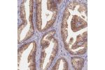 Immunohistochemical staining of human prostate shows strong cytoplasmic and membranous positivity in glandular cells.