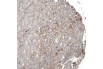 Immunohistochemical staining of human Stomach shows moderate extracellular space positivity in glandular cells.