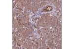 Immunohistochemical staining of human pancreas shows moderate cytoplasmic positivity in exocrine glandular cells.