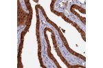 Immunohistochemical staining of human Fallopian tube shows strong cytoplasmic positivity in glandular cells.
